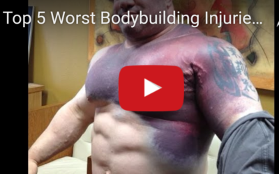 The 5 Worst Bodybuilding Injuries Ever :(