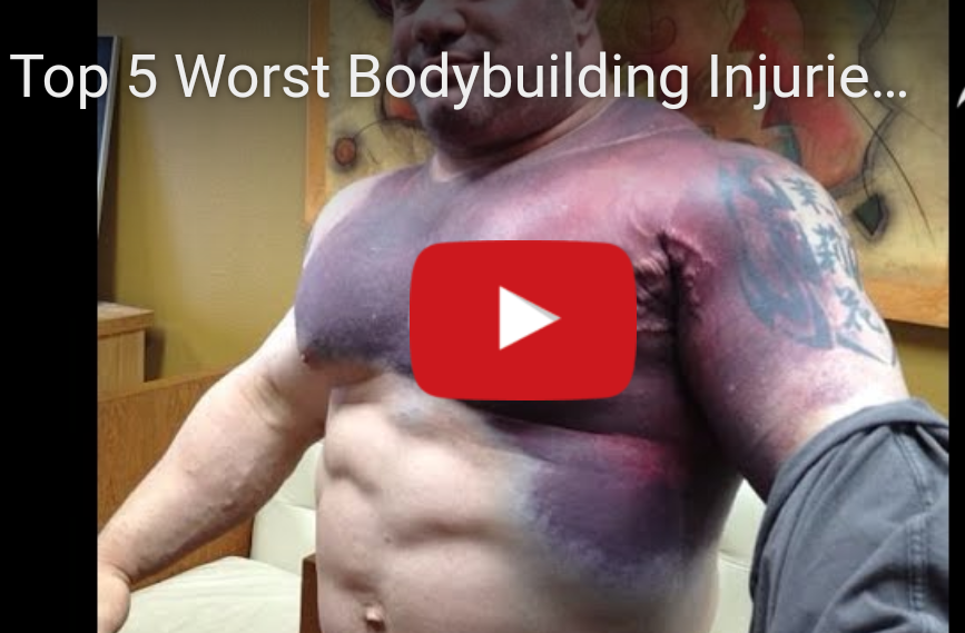 The 5 Worst Bodybuilding Injuries Ever :(